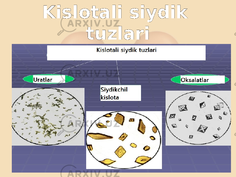 Kislotali siydik tuzlari 