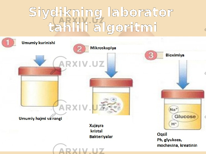 Siydikning laborator tahlili algoritmi 