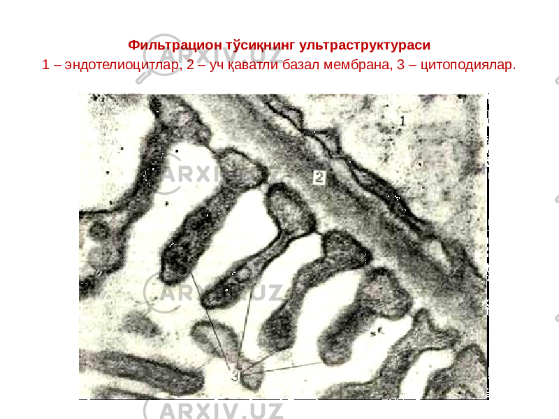 Фильтрацион тўсиқнинг ультраструктураси 1 – эндотелиоцитлар, 2 – уч қаватли базал мембрана, 3 – цитоподиялар. 