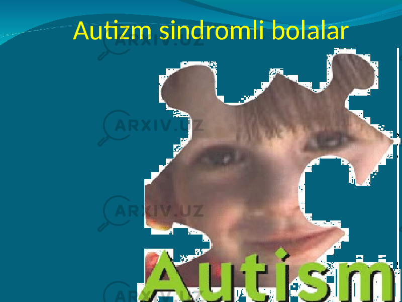 Autizm sindromli bolalar 