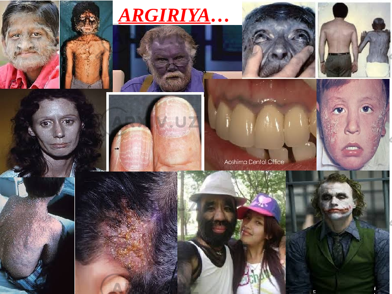 ARGIRIYA … 