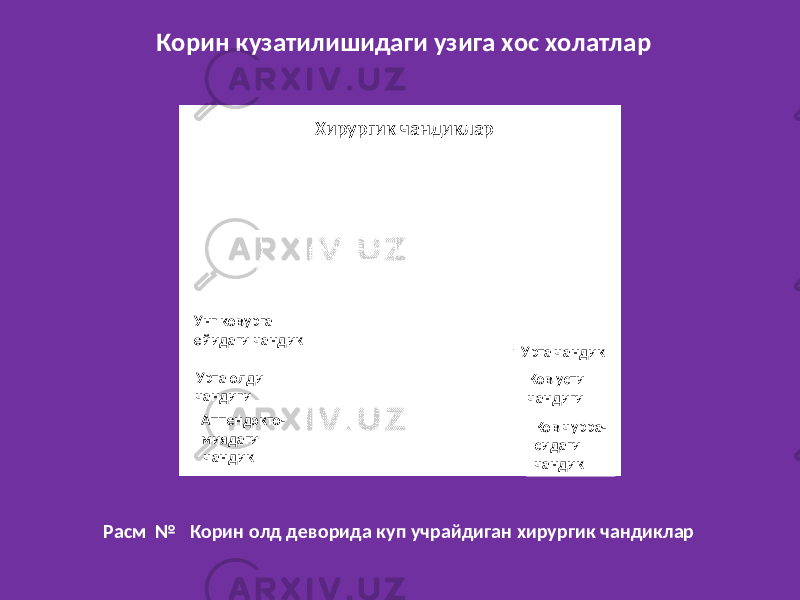 Корин кузатилишидаги узига хос холатлар Расм № Корин олд деворида куп учрайдиган хирургик чандиклар Хирургик чандиклар Унг ковурга ейидаги чандик Урта олди чандиги Аппендэкто- миядаги чандик Урта чандик Ков усти чандиги Ков чурра- сидаги чандик 