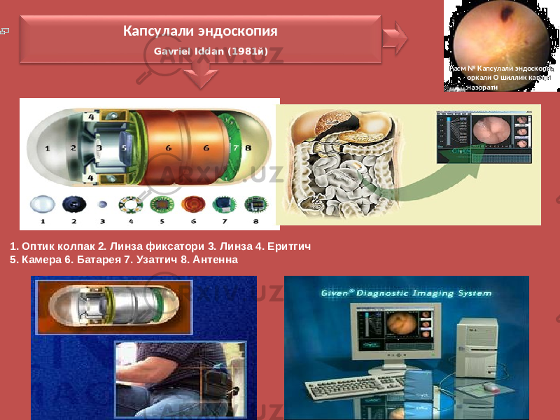  1. Оптик колпак 2. Линза фиксатори 3. Линза 4. Еритгич 5. Камера 6. Батарея 7. Узатгич 8. Антенна Расм № Капсулали эндоскопия оркали О шиллик кавати назорати Капсулали эндоскопия Gavriel Iddan (1981й) 