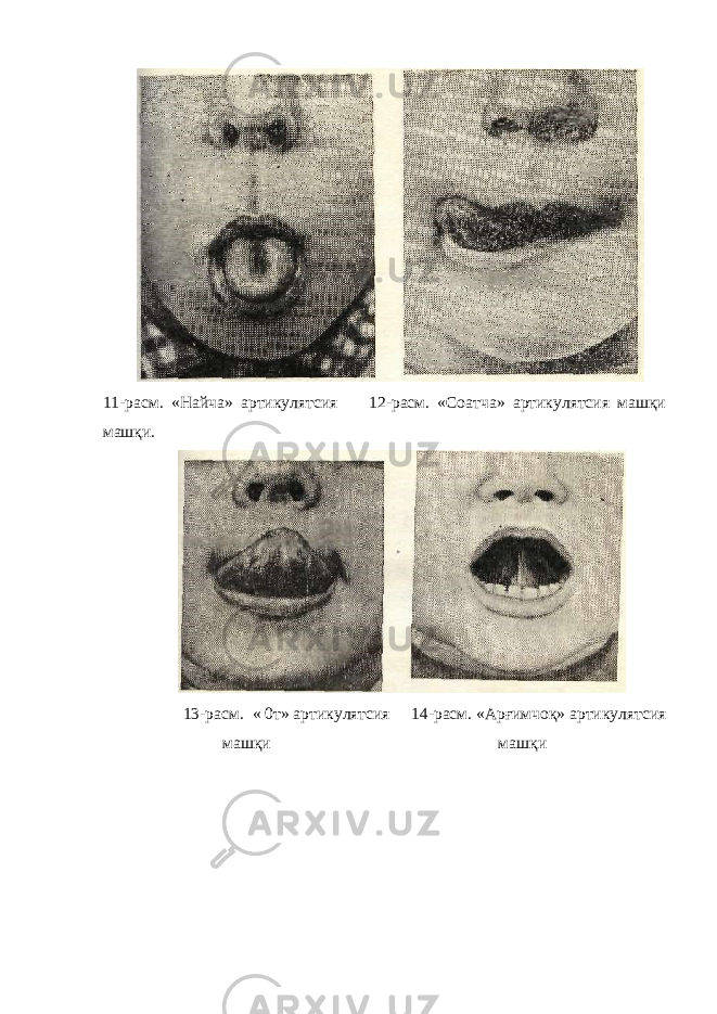  11-расм. «Найча» артикулятсия 12-расм. «Соатча» артикулятсия машқи машқи. 13-расм. « 0т» артикулятсия 14-расм. «Арғимчоқ» артикулятсия машқи машқи 