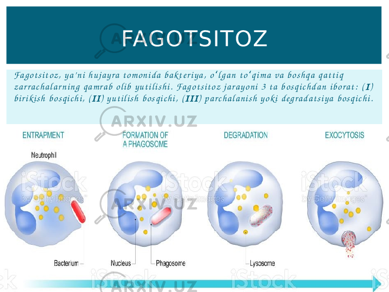 Fa g o t s i t o z , y a’ n i h u j a y r a t o m o n i d a b a k t e r i y a , o l g a n t o q i m a v a b o s h q a q a t t i q ʻ ʻ z a r r a c h a l a r n i n g q a m r a b o l i b y u t i l i s h i . Fa g o t s i t o z j a r a y o n i 3 t a b o s q i c h d a n i b o r a t : ( I ) b i r i k i s h b o s q i c h i , ( I I ) y u t i l i s h b o s q i c h i , ( I I I ) p a r c h a l a n i s h y o k i d e g r a d a t s i y a b o s q i c h i .FAGOTSITOZ 