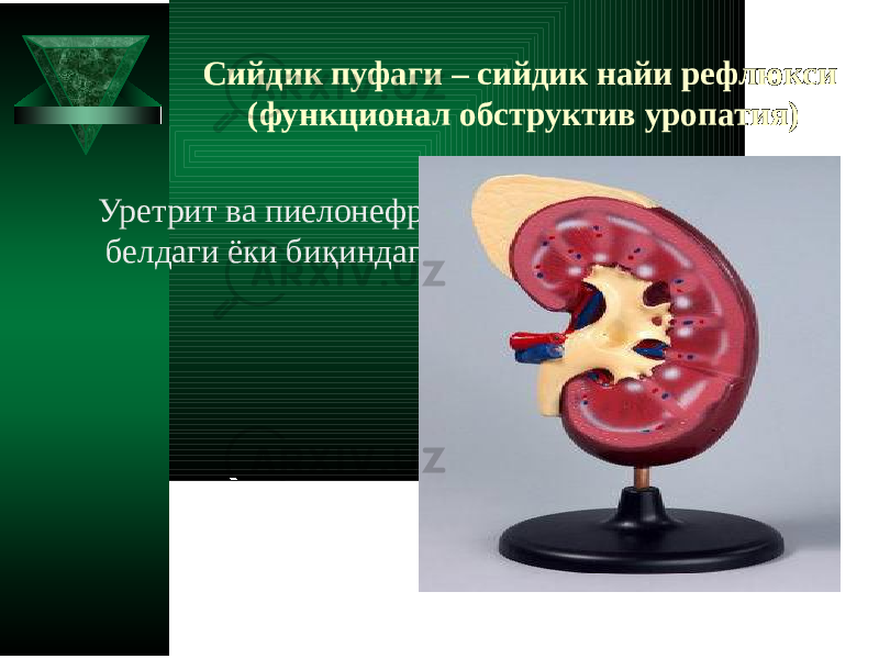 Сийдик пуфаги – сийдик найи рефлюкси (функционал обструктив уропатия) Уретрит ва пиелoнефрит симптомларига белдаги ёки биқиндаги оғриқ қўшилади 