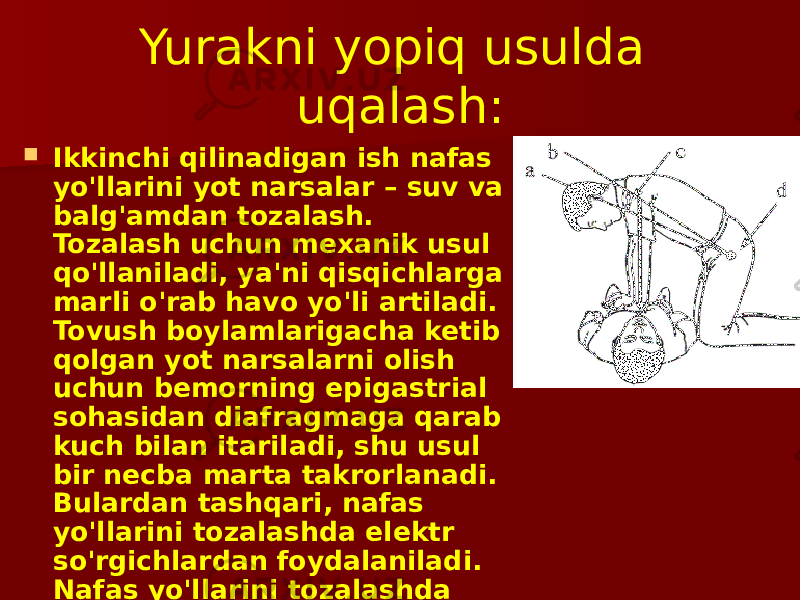 Yurakni yopiq usulda uqalash:  Ikkinchi qilinadigan ish nafas yo&#39;llarini yot narsalar – suv va balg&#39;amdan tozalash. Tozalash uchun mexanik usul qo&#39;llaniladi, ya&#39;ni qisqichlarga marli o&#39;rab havo yo&#39;li artiladi. Tovush boylamlarigacha ketib qolgan yot narsalarni olish uchun bemorning epigastrial sohasidan diafragmaga qarab kuch bilan itariladi, shu usul bir necba marta takrorlanadi. Bulardan tashqari, nafas yo&#39;llarini tozalashda elektr so&#39;rgichlardan foydalaniladi. Nafas yo&#39;llarini tozalashda laringoskopiyaning roli katta. 