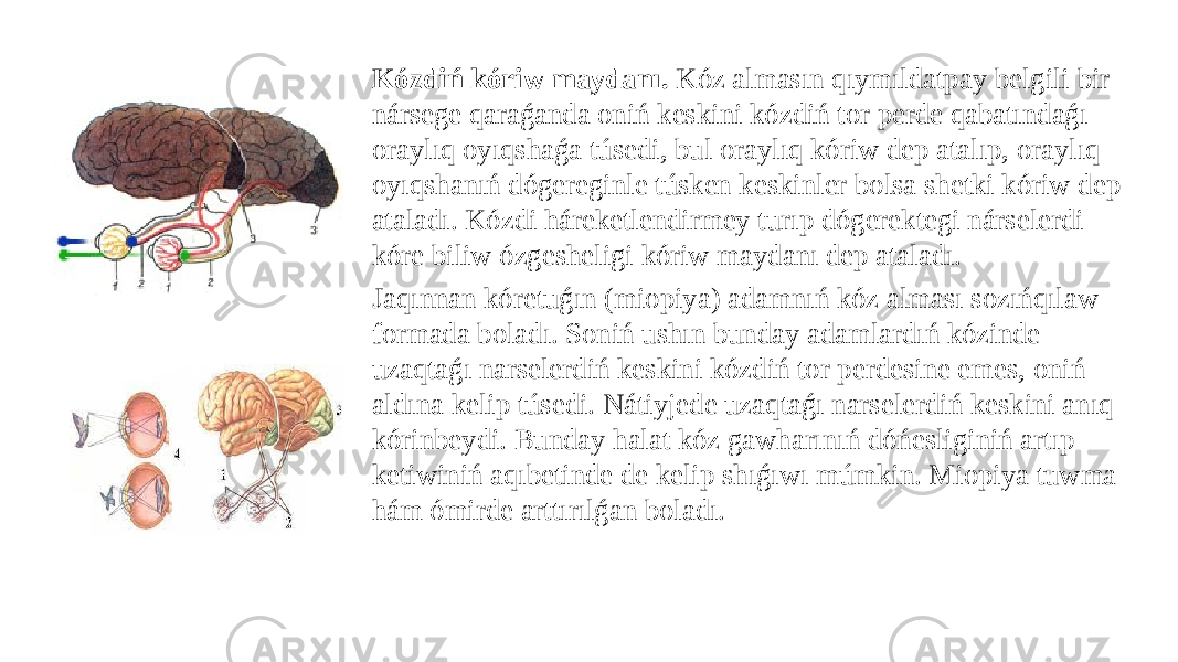Kózdiń kóriw maydanı. Kóz almasın qıymıldatpay belgili bir nársege qaraǵanda oniń keskini kózdiń tor perde qabatındaǵı oraylıq oyıqshaǵa túsedi, bul oraylıq kóriw dep atalıp, oraylıq oyıqshanıń dógereginle túsken keskinler bolsa shetki kóriw dep ataladı. Kózdi háreketlendirmey turıp dógerektegi nárselerdi kóre biliw ózgesheligi kóriw maydanı dep ataladı. Jaqınnan kóretuǵın (miopiya) adamnıń kóz alması sozıńqılaw formada boladı. Soniń ushın bunday adamlardıń kózinde uzaqtaǵı narselerdiń keskini kózdiń tor perdesine emes, oniń aldına kelip túsedi. Nátiyjede uzaqtaǵı narselerdiń keskini anıq kórinbeydi. Bunday halat kóz gawharınıń dóńesliginiń artıp ketiwiniń aqıbetinde de kelip shıǵıwı múmkin. Miopiya tuwma hám ómirde arttırılǵan boladı. 
