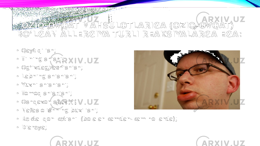 OZIQ-OVQAT MAHSULOTLARIGA (OZIQ-OVQAT) BO’LGAN ALLERGIYA TURLI REAKSIYALARGA EGA: • Qayt qilish; • Tilning shishi; • Og’izdagi achishish; • Labning shishishi; • Yuzni shishishi; • Tomoq shishishi; • Oshqazon spazmi; • Nafas olishning buzilishi; • Rektal qon ketishi (bolalar kamdan-kam hollarda); • Diareya; 