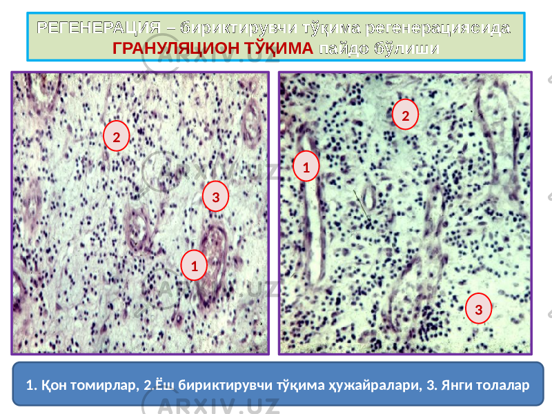 РЕГЕНЕРАЦИЯ – бириктирувчи тўқима регенерациясида ГРАНУЛЯЦИОН ТЎҚИМА пайдо бўлиши 1. Қон томирлар, 2.Ёш бириктирувчи тўқима ҳужайралари, 3. Янги толалар 1 12 2 3 3 
