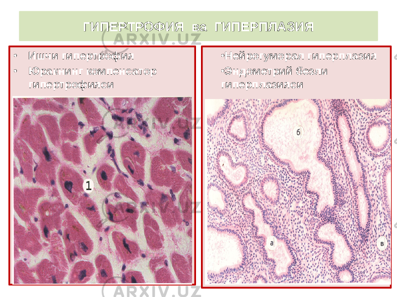 • Ишчи гипертрофия • Юракнинг компенсатор гипертрофияси • Нейрогуморал гиперплазия • Эндометрий безли гиперплазиясиГИПЕРТРОФИЯ ва ГИПЕРПЛАЗИЯ 