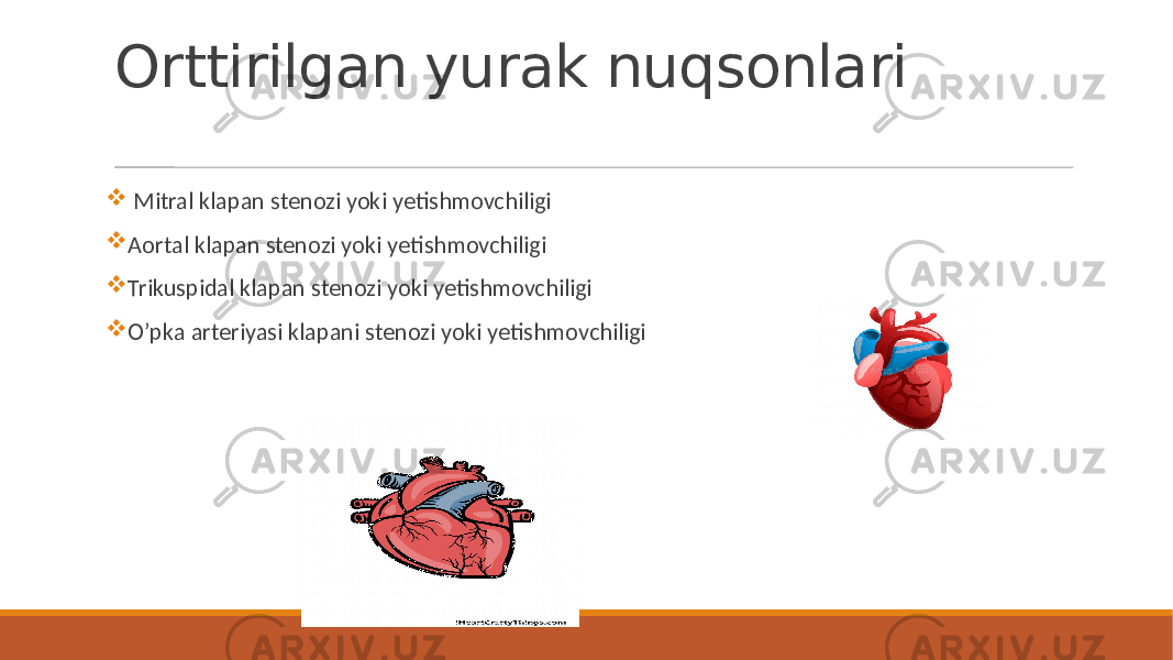 Orttirilgan yurak nuqsonlari  Mitral klapan stenozi yoki yetishmovchiligi  Aortal klapan stenozi yoki yetishmovchiligi  Trikuspidal klapan stenozi yoki yetishmovchiligi  O’pka arteriyasi klapani stenozi yoki yetishmovchiligi 