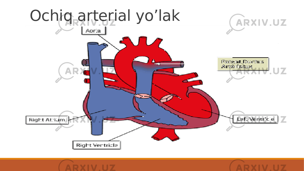 Ochiq arterial yo’lak 