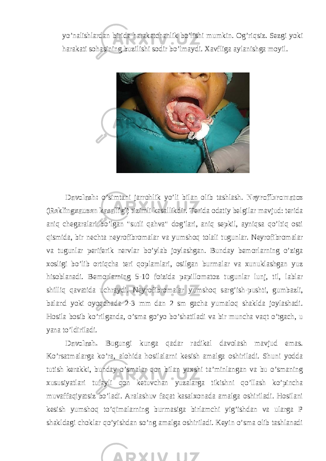 yo’nalishlardan birida harakatchanlik bo’lishi mumkin. Og’riqsiz. Sezgi yoki harakati sohasining buzilishi sodir bo’lmaydi. Xavfliga aylanishga moyil. Davolash: o’simtani jarrohlik yo’li bilan olib tashlash. Neyrofibromatoz (Reklingxauzen kasalligi) tizimli kasallikdir. Terida odatiy belgilar mavjud: terida aniq chegaralari bo’lgan &#34;sutli qahva&#34; dog’lari, aniq sepkil, ayniqsa qo’ltiq osti qismida, bir nechta neyrofibromalar va yumshoq tolali tugunlar. Neyrofibromalar va tugunlar periferik nervlar bo’ylab joylashgan. Bunday bemorlarning o’ziga xosligi bo’lib ortiqcha teri qoplamlari, osilgan burmalar va xunuklashgan yuz hisoblanadi. Bemorlarning 5-10 foizida papillomatoz tugunlar lunj, til, lablar shilliq qavatida uchraydi. Neyrofibromalar yumshoq sarg’ish-pushti, gumbazli, baland yoki oyoqchada 2-3 mm dan 2 sm gacha yumaloq shaklda joylashadi. Hosila bosib ko’rilganda, o’sma go’yo bo’shatiladi va bir muncha vaqt o’tgach, u yana to’ldiriladi. Davolash. Bugungi kunga qadar radikal davolash mavjud emas. Ko’rsatmalarga ko’ra, alohida hosilalarni kesish amalga oshiriladi. Shuni yodda tutish kerakki, bunday o’smalar qon bilan yaxshi ta’minlangan va bu o’smaning xususiyatlari tufayli qon ketuvchan yuzalarga tikishni qo’llash ko’pincha muvaffaqiyatsiz bo’ladi. Aralashuv faqat kasalxonada amalga oshiriladi. Hosilani kesish yumshoq to’qimalarning burmasiga birlamchi yig’ishdan va ularga P shakldagi choklar qo’yishdan so’ng amalga oshiriladi. Keyin o’sma olib tashlanadi 