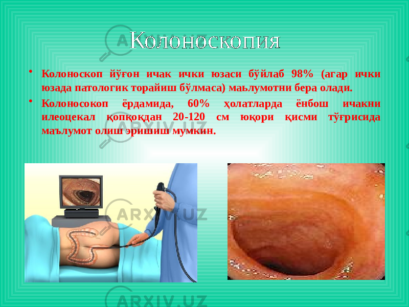 • Колоноскоп йўғон ичак ички юзаси бўйлаб 98% (агар ички юзада патологик торайиш бўлмаса) маьлумотни бера олади. • Колоносокоп ёрдамида, 60% ҳолатларда ёнбош ичакни илеоцекал қопқоқдан 20-120 см юқори қисми тўғрисида маълумот олиш эришиш мумкин. Колоноскопия 