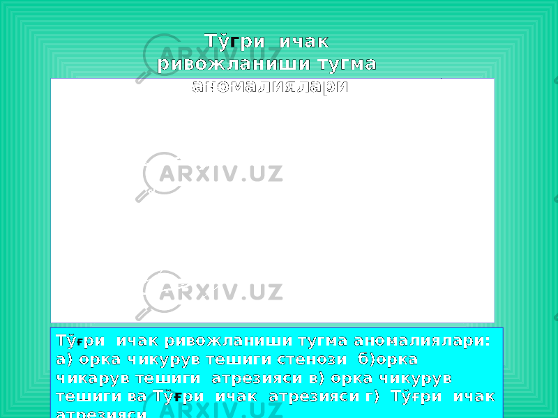 Тў Ғ ри ичак ривожланиши тугма аномалиялари: а) орка чикурув тешиги стенози б)орка чикарув тешиги атрезияси в) орка чикурув тешиги ва Тў ғ ри ичак атрезияси г) Тўғри ичак атрезияси Тў г ри ичак ривожланиши тугма аномалиялари 