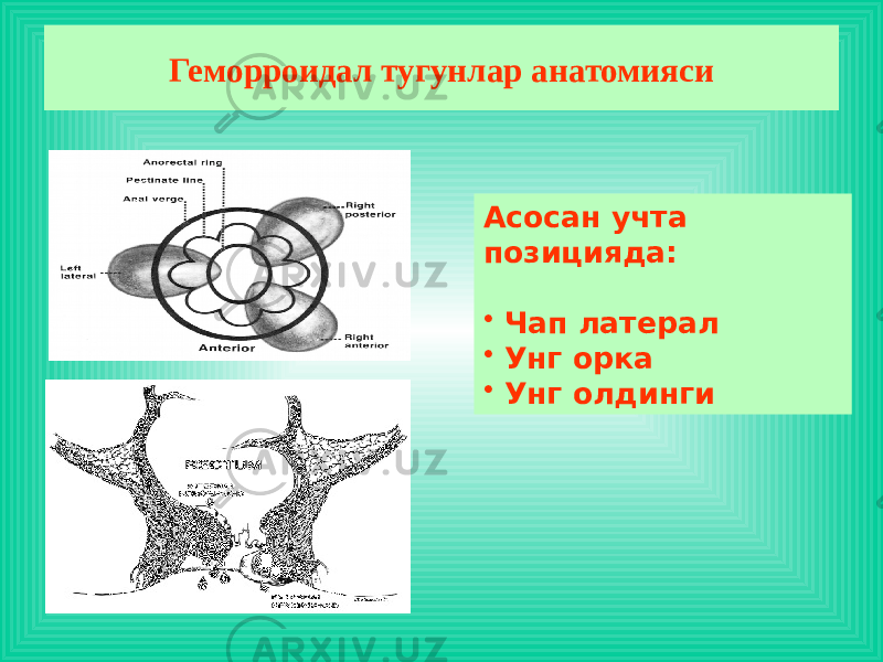 Геморроидал тугунлар анатомияси Асосан учта позицияда: • Чап латерал • Унг орка • Унг олдинги 