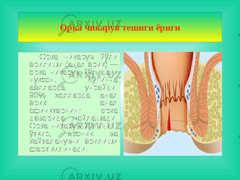  Орқа чиқарув йўли ёрилиши (анал ёриқ) — орқа чиқарув йўлидаги нуқсон. Кўпинча аёлларда учрайди. 90% холларда анал ёриқ анал сфинктернинг орқа деворида жойлашади. Орқа чиқарув йўлининг ўткир, хроник ва қайталанувчи ёрилиши фарқ қилинади. Орка чикарув тешиги ёриги 