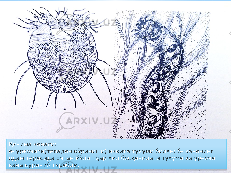 Қичима канаси: а- урғочиси(тепадан кўриниши) иккита тухуми билан; б- кананинг одам терисида очган йўли: ҳар хил босқичидаги тухуми ва урғочи кана кўриниб турибди.39 09 0E 12 