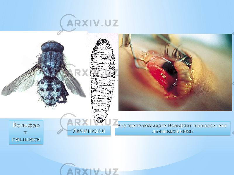 Кўз эпителийсидаги Вольфарт пашшасининг личинкаси(миаз)Вольфар т пашшаси личинкаси32 23 4B 08 22 230C 