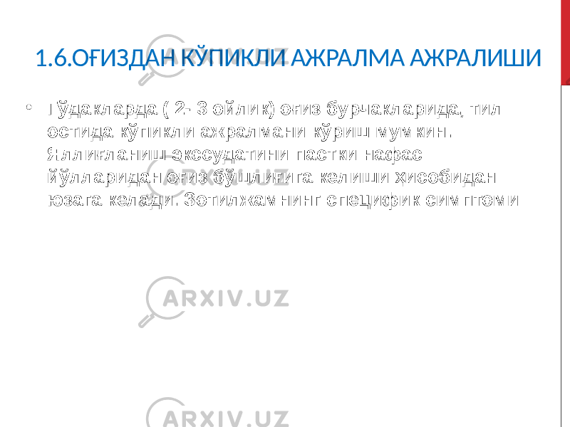 1.6.ОҒИЗДАН КЎПИКЛИ АЖРАЛМА АЖРАЛИШИ • Гўдакларда ( 2- 3 ойлик) оғиз бурчакларида, тил остида кўпикли ажралмани кўриш мумкин. Яллиғланиш экссудатини пастки нафас йўлларидан оғиз бўшлиғига келиши ҳисобидан юзага келади. Зотилжамнинг специфик симптоми 