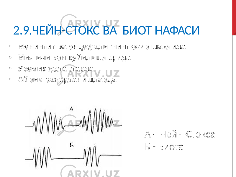  2.9.ЧЕЙН-СТОКС ВА БИОТ НАФАСИ • Менингит ва энцефалитнинг оғир шаклида • Мия ичи қон қуйилишларида • Уремик ҳолатларда • Айрим заҳарланишларда А – Чейн-Стокса Б - Биота 