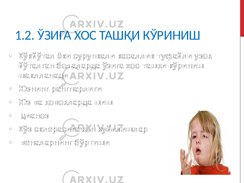 1.2. ЎЗИГА ХОС ТАШҚИ КЎРИНИШ • Кўкйўтал ёки сурункали касаллик туфайли узоқ йўталган болаларда ўзига хос ташқи кўриниш шаклланади • Юзнинг рангпарлиги • Юз ва қовоқларда шиш • цианоз • Кўз склерасига қон қуйилишлар • веналарнинг бўртиши 