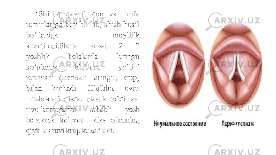 • Shilliq qavati qon va limfa tomirlariga boy bo’lib, shish hosil bo’lishiga moyillik kuzatiladi.Shular sabab 2- 3 yoshlik bolalarda laringit ko’pincha hiqildoq yo’lini torayishi (stenozli laringit, krup) bilan kechadi. Hiqildoq ovoz mushaklari qisqa, elastik to’qimasi rivojlanmagangi sababli yosh bolalarda ko’proq nafas olishning qiyinlashuvi krup kuzatiladi. 