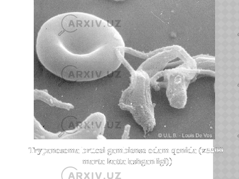 Trypanosoma brucei gambiense odam qonida (x5500 marta kattalashganligi) ) 