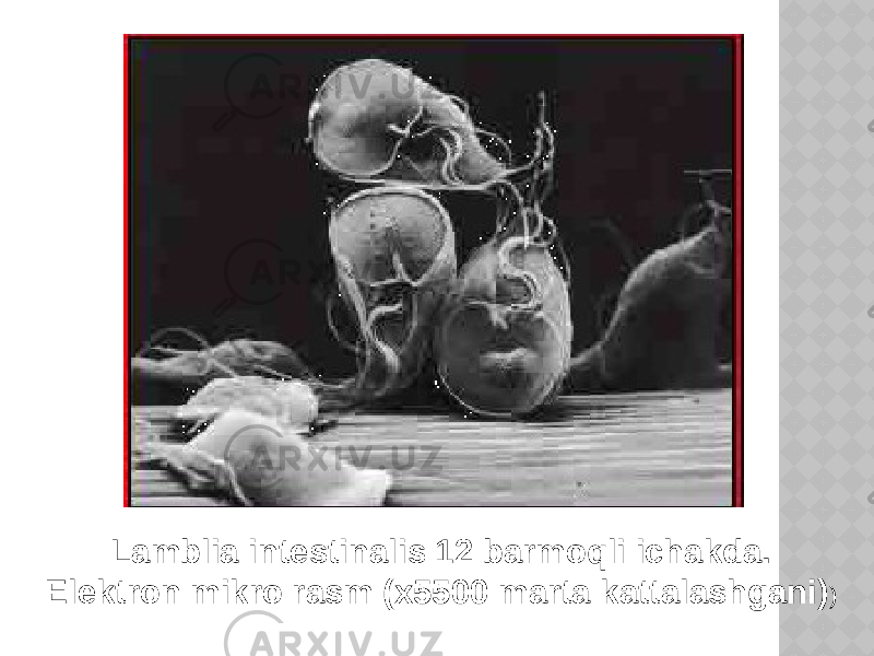 Lamblia intestinalis 12 barmoqli ichakda. Elektron mikro rasm (x5500 marta kattalashgani) ) 