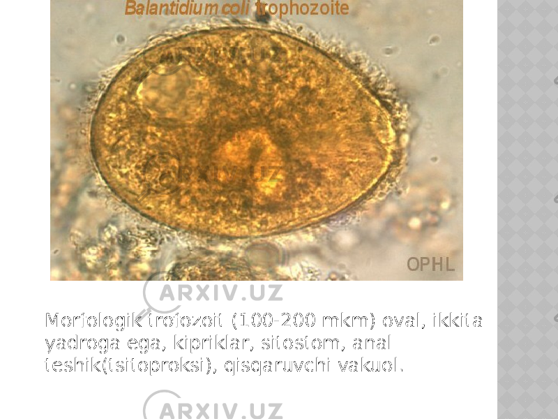 Morfologik trofozoit (100-200 mkm) oval, ikkita yadroga ega, kipriklar, sitostom, anal teshik(tsitoproksi), qisqaruvchi vakuol. 