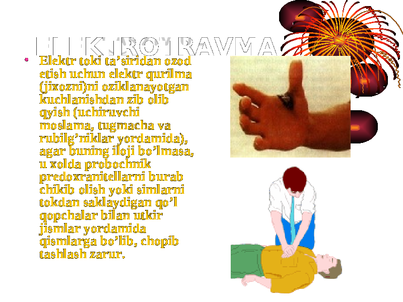 ELEKTROTRAVMA • Elektr toki ta’siridan ozod etish uchun elektr qurilma (jixozni)ni oziklanayotgan kuchlanishdan zib olib qyish (uchiruvchi moslama, tugmacha va rubilg’niklar yordamida), agar buning iloji bo’lmasa, u xolda probochnik predoxranitellarni burab chikib olish yoki simlarni tokdan saklaydigan qo’l qopchalar bilan utkir jismlar yordamida qismlarga bo’lib, chopib tashlash zarur. 