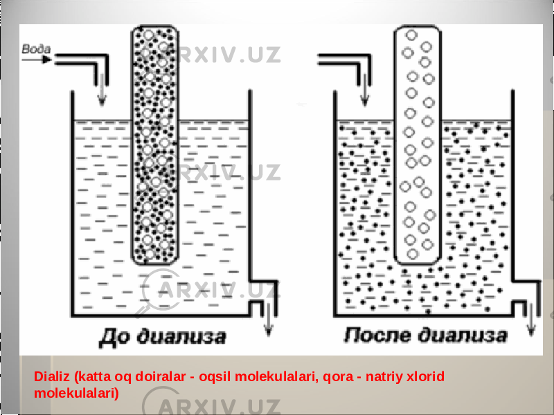 Dializ (katta oq doiralar - oqsil molekulalari, qora - natriy xlorid molekulalari) 