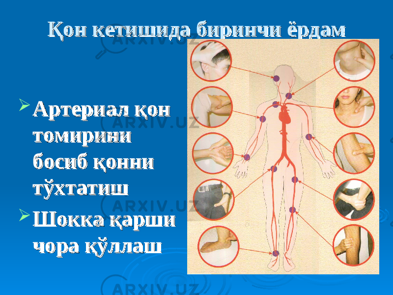 Қон кетишида биринчи ёрдамҚон кетишида биринчи ёрдам  Артериал қон Артериал қон томирини томирини босиб қонни босиб қонни тўхтатиштўхтатиш  Шокка қарши Шокка қарши чора қўллашчора қўллаш 