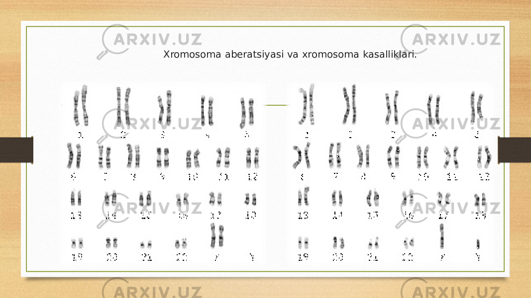 Xromosoma aberatsiyasi va xromosoma kasalliklari. 
