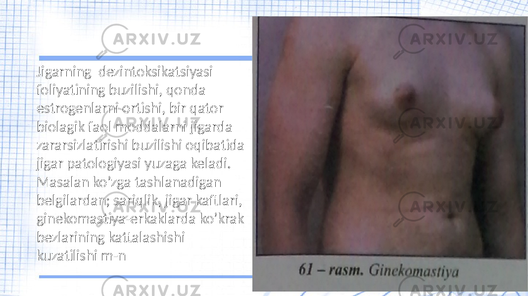 Jigarning dezintoksikatsiyasi foliyatining buzilishi, qonda estrogenlarni ortishi, bir qator biolagik faol moddalarni jigarda zararsizlatirishi buzilishi oqibatida jigar patologiyasi yuzaga keladi. Masalan ko’zga tashlanadigan belgilardan; sariqlik, jigar kaftlari, ginekomastiya-erkaklarda ko’krak bezlarining kattalashishi kuzatilishi m-n 