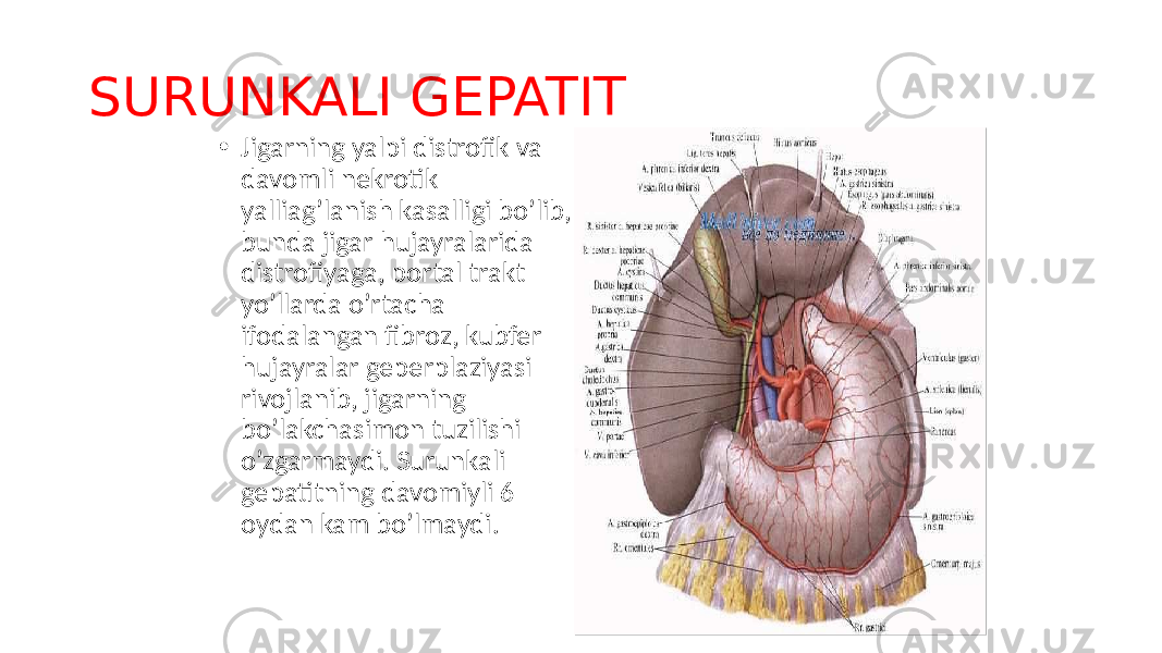 • Jigarning yalpi distrofik va davomli nekrotik yalliag’lanish kasalligi bo’lib, bunda jigar hujayralarida distrofiyaga, portal trakt yo’llarda o’rtacha ifodalangan fibroz, kubfer hujayralar geperplaziyasi rivojlanib, jigarning bo’lakchasimon tuzilishi o’zgarmaydi. Surunkali gepatitning davomiyli 6 oydan kam bo’lmaydi.SURUNKALI GEPATIT 