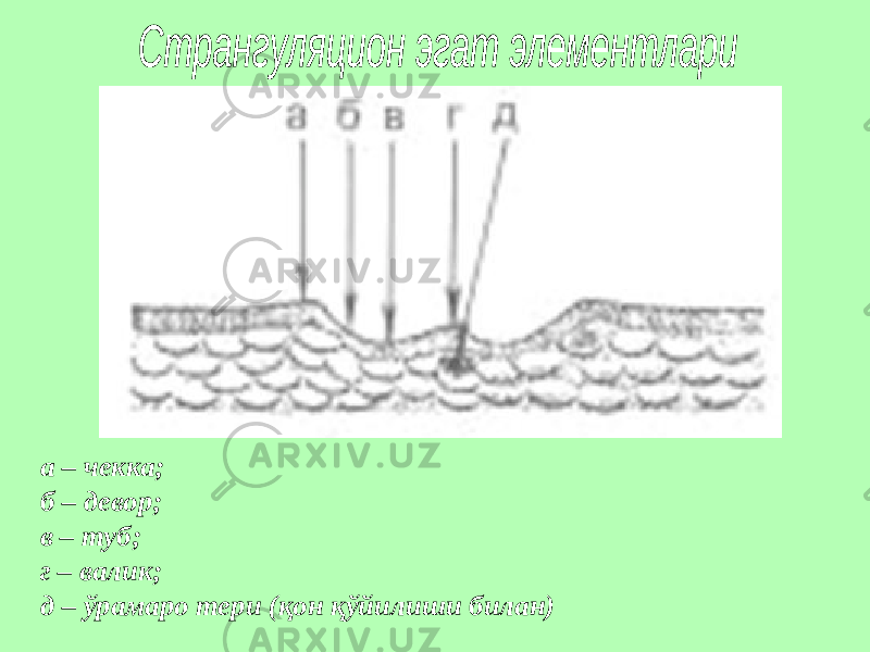 а – чекка; б – девор; в – туб; г – валик; д – ўрамаро тери (қон қўйилиши билан) 