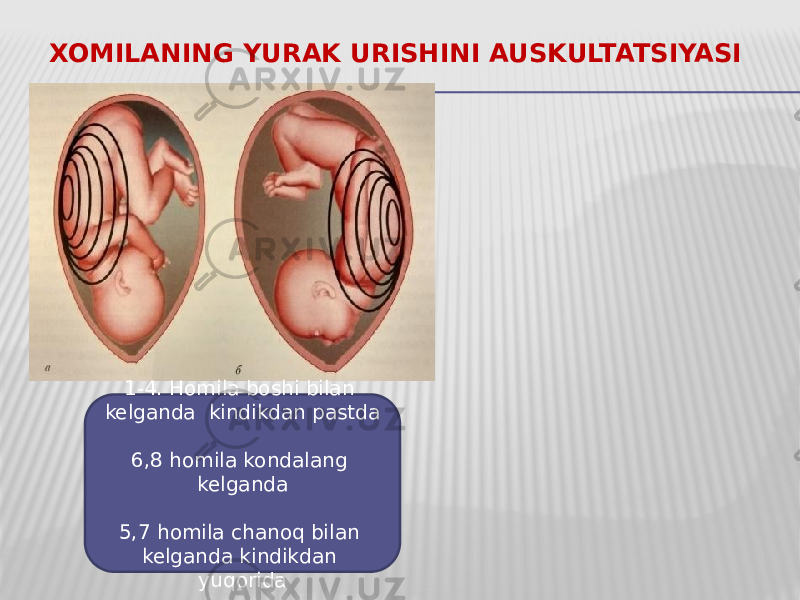 XOMILANING YURAK URISHINI AUSKULTATSIYASI 1-4. Homila boshi bilan kelganda kindikdan pastda 6,8 homila kondalang kelganda 5,7 homila chanoq bilan kelganda kindikdan yuqorida 