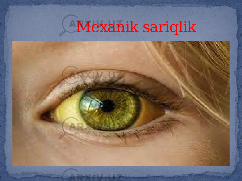  Mexanik sariqlik 