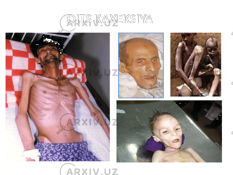 OITS KAXEKSIYA 