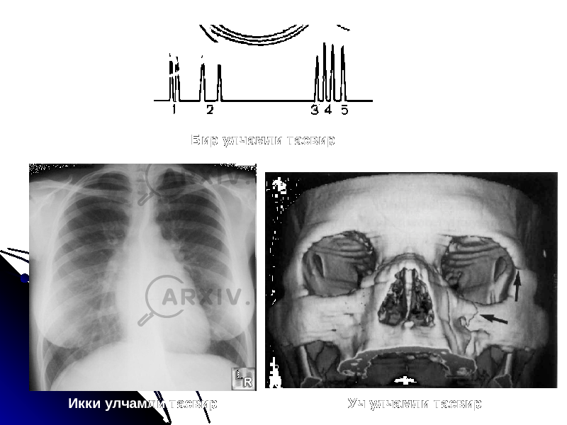 Бир улчамли тасвир Икки улчамли тасвир Уч улчамли тасвир 