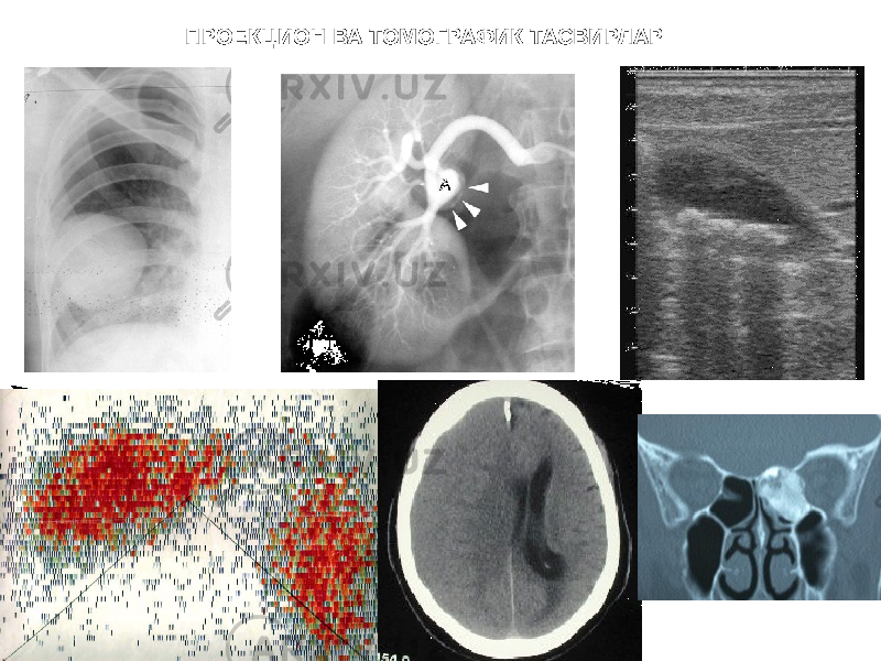 ПРОЕКЦИОН ВА ТОМОГРАФИК ТАСВИРЛАР 