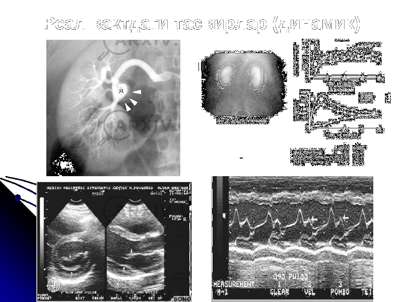 Реал вактдаги тасвирлар (динамик) 