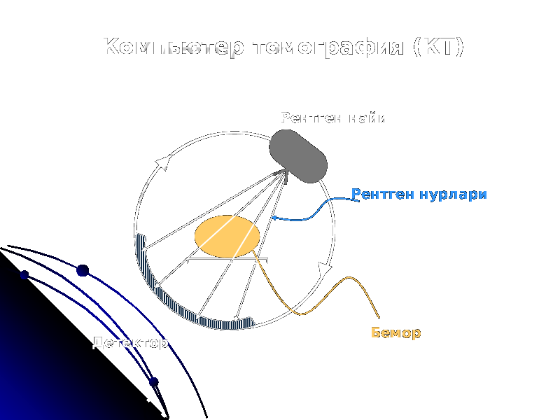 Компьютер томография (КT) Детектор Рентген найи Рентген нурлари Бемор 