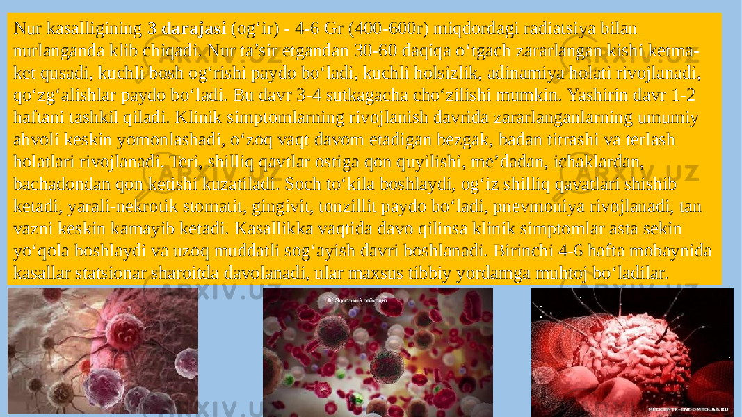 Nur kasalligining 3 darajasi (og‘ir) - 4-6 Gr (400-600r) miqdordagi radiatsiya bilan nurlanganda klib chiqadi. Nur ta’sir etgandan 30-60 daqiqa o‘tgach zararlangan kishi ketma- ket qusadi, kuchli bosh og‘rishi paydo bo‘ladi, kuchli holsizlik, adinamiya holati rivojlanadi, qo‘zg‘alishlar paydo bo‘ladi. Bu davr 3-4 sutkagacha cho‘zilishi mumkin. Yashirin davr 1-2 haftani tashkil qiladi. Klinik simptomlarning rivojlanish davrida zararlanganlarning umumiy ahvoli keskin yomonlashadi, o‘zoq vaqt davom etadigan bezgak, badan titrashi va terlash holatlari rivojlanadi. Teri, shilliq qavtlar ostiga qon quyilishi, me’dadan, ichaklardan, bachadondan qon ketishi kuzatiladi. Soch to‘kila boshlaydi, og‘iz shilliq qavatlari shishib ketadi, yarali-nekrotik stomatit, gingivit, tonzillit paydo bo‘ladi, pnevmoniya rivojlanadi, tan vazni keskin kamayib ketadi. Kasallikka vaqtida davo qilinsa klinik simptomlar asta sekin yo‘qola boshlaydi va uzoq muddatli sog‘ayish davri boshlanadi. Birinchi 4-6 hafta mobaynida kasallar statsionar sharoitda davolanadi, ular maxsus tibbiy yordamga muhtoj bo‘ladilar. 