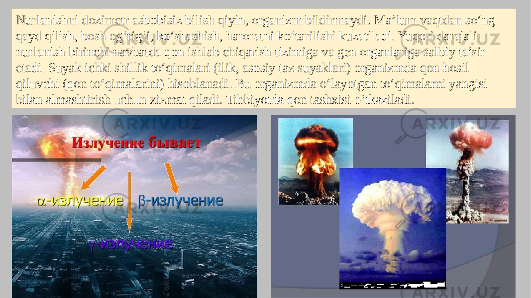 Nurlanishni dozimetr asbobisiz bilish qiyin, organizm bildirmaydi. Ma’lum vaqtdan so‘ng qayd qilish, bosh og‘rig‘i, bo‘shashish, haroratni ko‘tarilishi kuzatiladi. Yuqori darajali nurlanish birinchi navbatda qon ishlab chiqarish tizimiga va gen organlariga salbiy ta’sir etadi. Suyak ichki shillik to‘qimalari (ilik, asosiy taz suyaklari) organizmda qon hosil qiluvchi (qon to‘qimalarini) hisoblanadi. Bu organizmda o‘layotgan to‘qimalarni yangisi bilan almashtirish uchun xizmat qiladi. Tibbiyotda qon tashxisi o‘tkaziladi. 