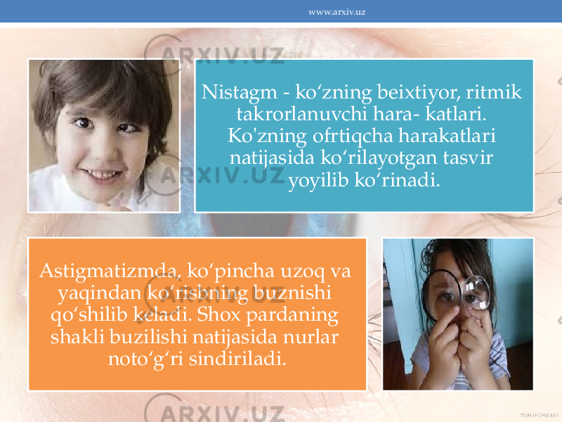 Nistagm - ko‘zning beixtiyor, ritmik takrorlanuvchi hara- katlari. Ko&#39;zning ofrtiqcha harakatlari natijasida ko‘rilayotgan tasvir yoyilib ko‘rinadi. Astigmatizmda, ko‘pincha uzoq va yaqindan ko‘risbning buznishi qo‘shilib keladi. Shox pardaning shakli buzilishi natijasida nurlar noto‘g‘ri sindiriladi. www.arxiv.uz 