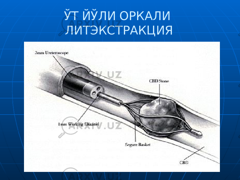  ЎТ ЙЎЛИ ОРКАЛИ ЛИТЭКСТРАКЦИЯ 