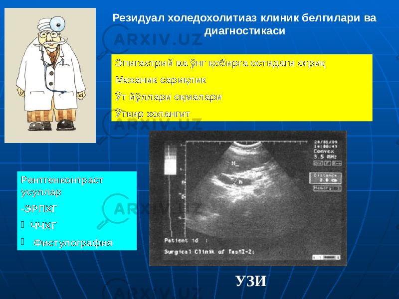 УЗИРезидуал холедохолитиаз клиник белгилари ва диагностикаси Эпигастрий ва ўнг қобирға остидаги оғриқ Механик сариқлик Ўт йўллари оқмалари Ўткир холангит Рентгенконтраст усуллар -ЭРПХГ  ЧЧХГ  Фистулография 